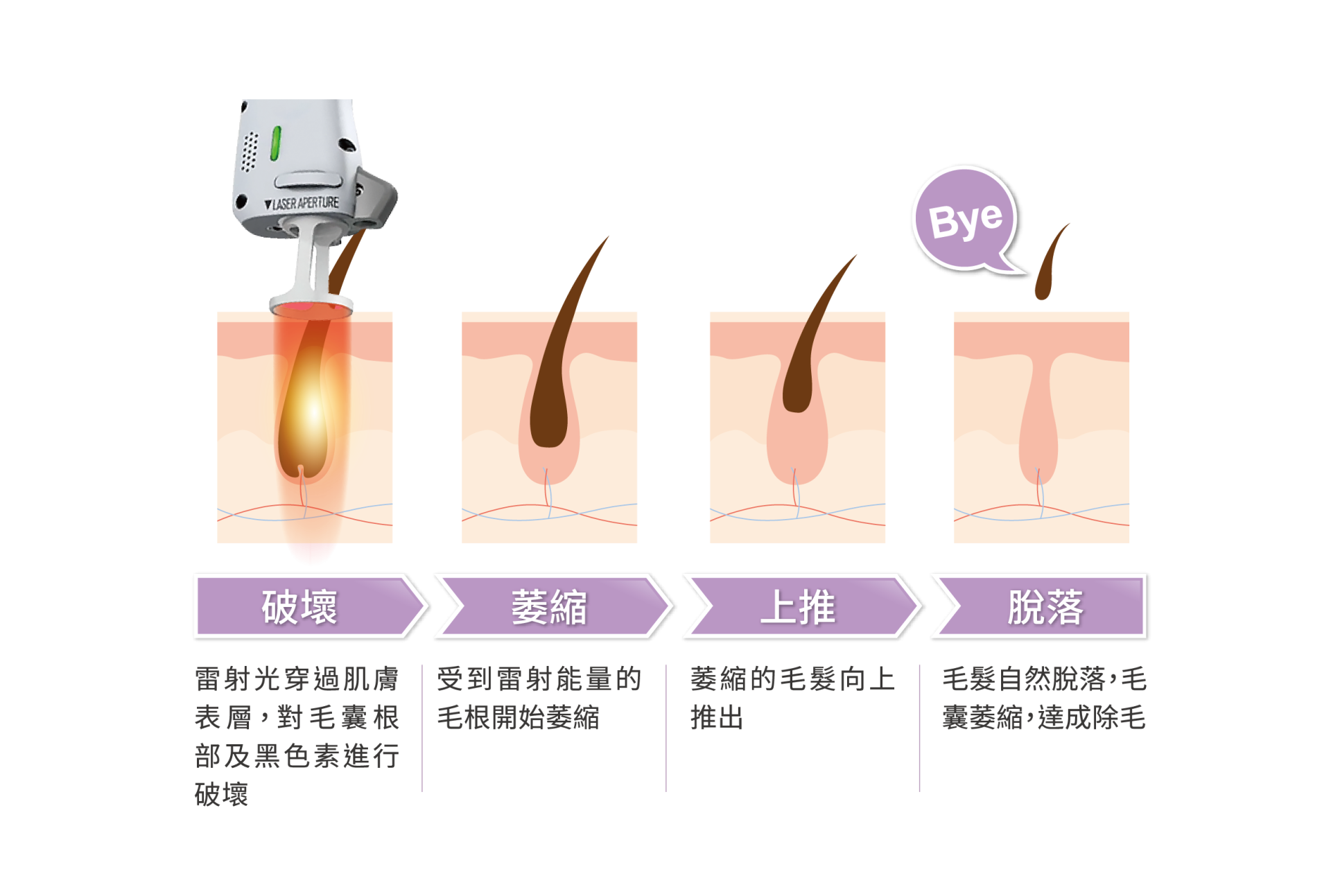 Clarity II克萊媞雷射2.0|一機多功能|全面性治療