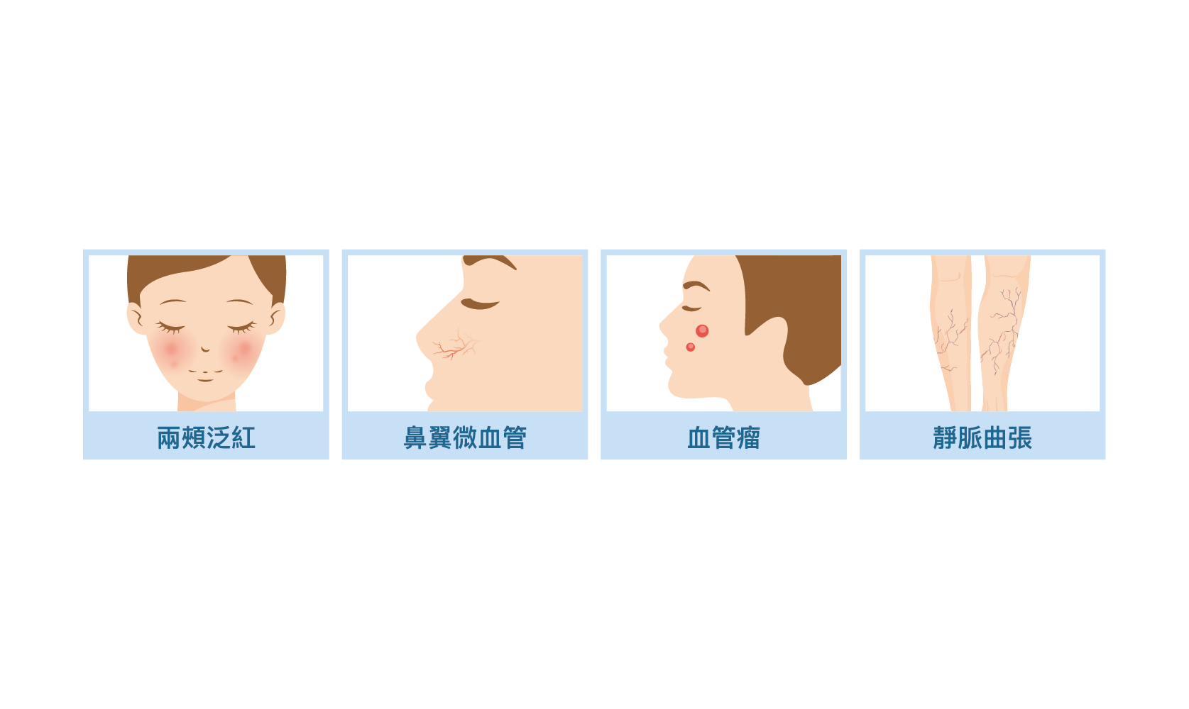 除血管-適用部位